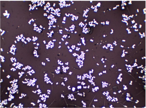 <p>Simple- Negative stain</p>