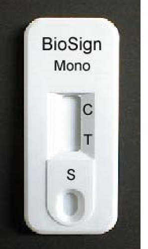 <p>• Can detect the IgM heterophile antibodies in serum, plasma or whole blood</p><p>• Color Immuno Chromatographic Assay</p><p>• Have built in control</p><p>• Fast</p><p>• Positive test- blue line</p><p>• Negative test – no blue line</p><p></p><p>QC:</p><p>• Store reagents at 2-8ºC</p><p>• Do not mix reagents from different kits</p><p>• Warm to RT before use</p><p>• Other tests: EBV Test (Epstein Barr Virus)</p>