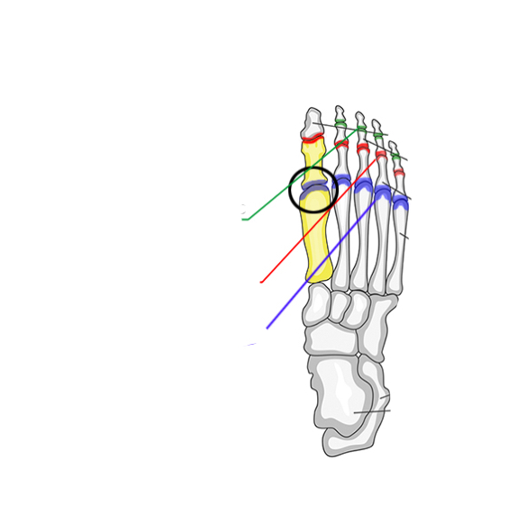 <p>Where is the <span><span>Proximal Interphalangeal (PIP) Joints</span></span></p>