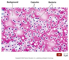 <p>Used to observe the microbial CAPSULE, a protective glycocalyx layer surrounding the cells of some bacteria and fungi</p><p>Mix of negative stain and direct stain</p>