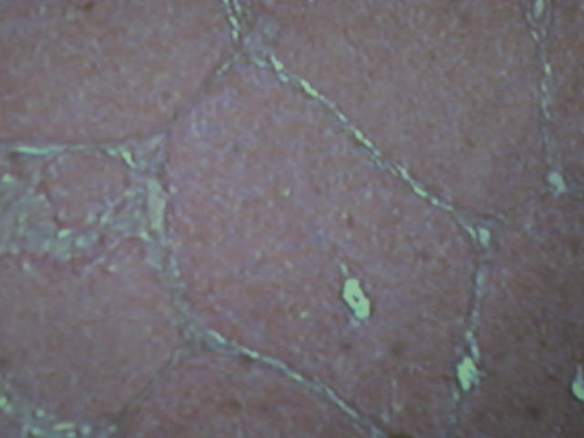<p>Identify?</p><p>Lab Image 7-22</p>
