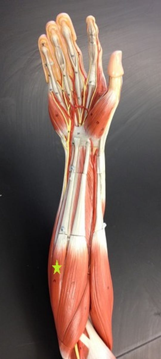 <p>flexion of wrist</p>