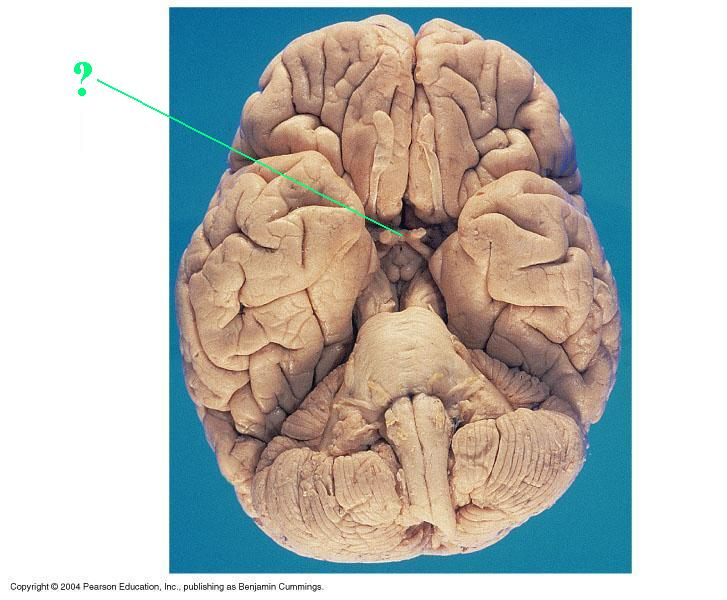 <p>Identify the indicated structure of the brain</p>