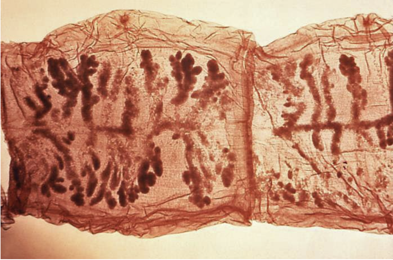 <p><span>Taenia solium — transmission & scolex ID?</span></p>