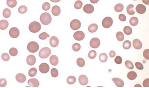 <p>RBC size variation</p>