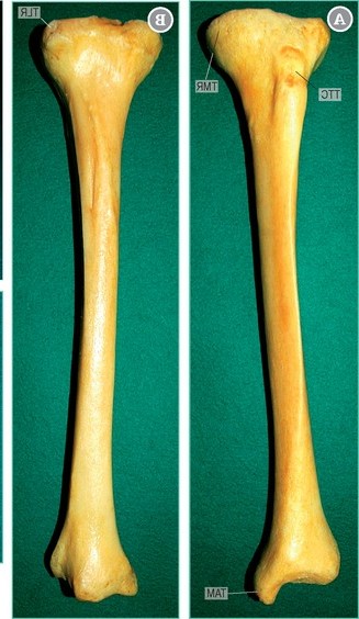 <p>name and side this bone</p>