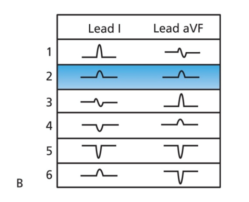 <p>Normal</p>