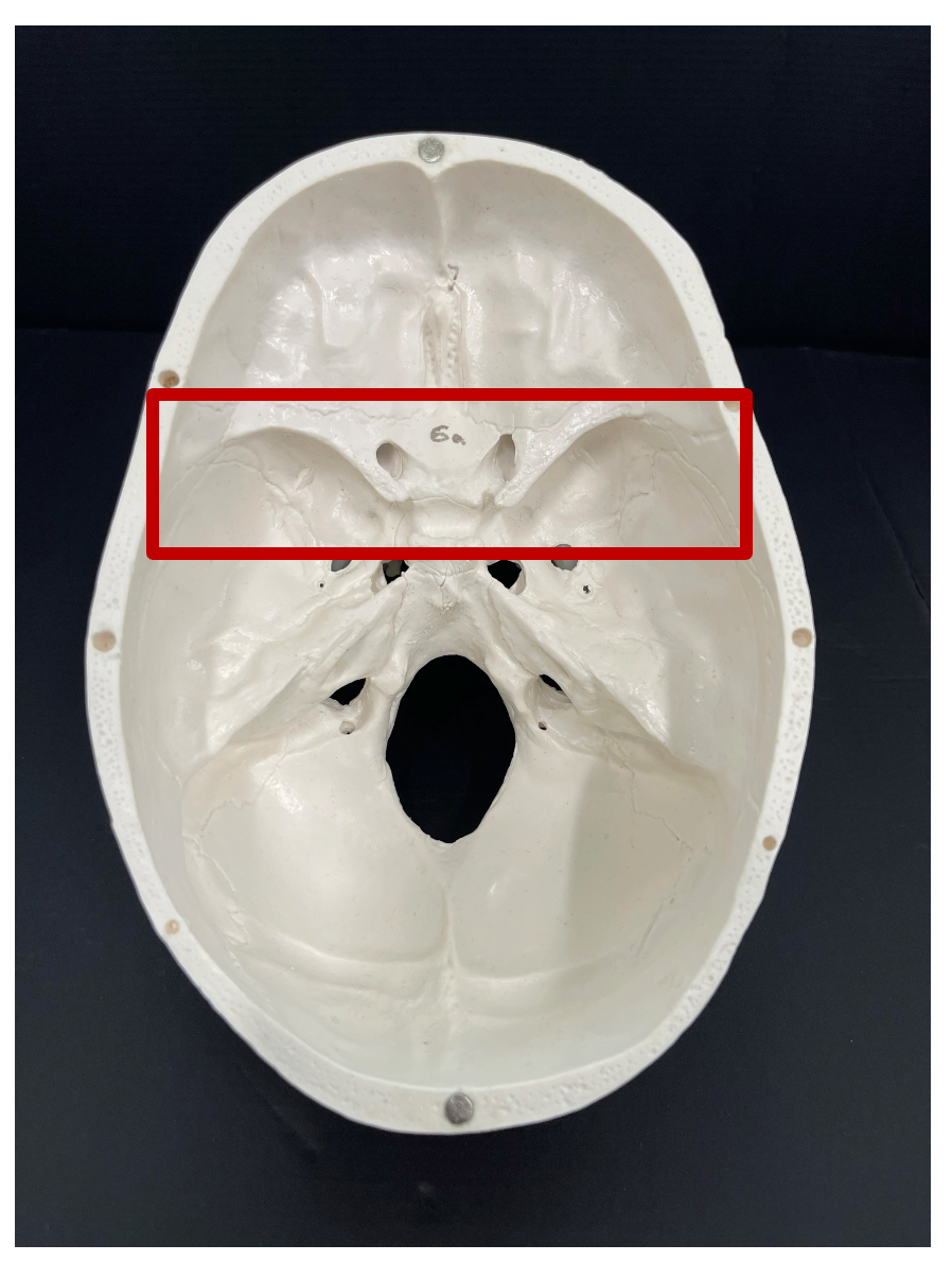<p>What is the name of the bone that contributes to the floor of the middle cranial fossa?</p>
