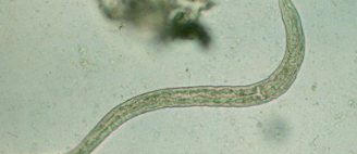 <p>Identify the causative agent</p>