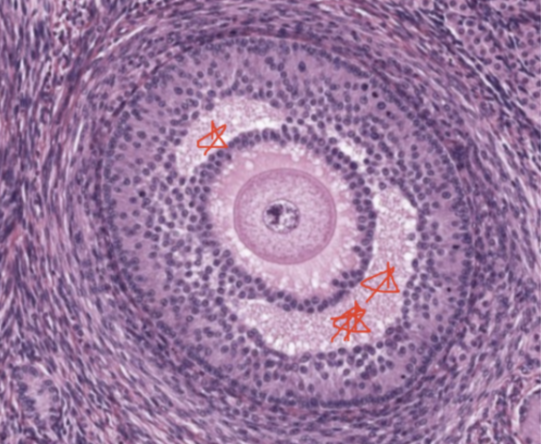 <p><span>Stage the follicle : Secondary follicle</span><br><span>Identify THE SPECIFIC REGION OR SPACE: : the antrum</span></p>