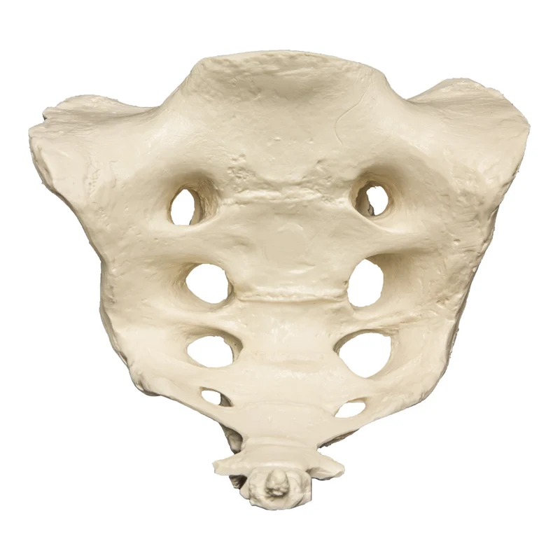 <p>What bone is this?</p>