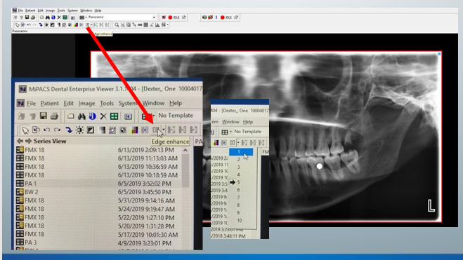 <p>-purpose is to improve image quality by removing blur or noise</p><p>-can change sharpness from 1 to 10</p>