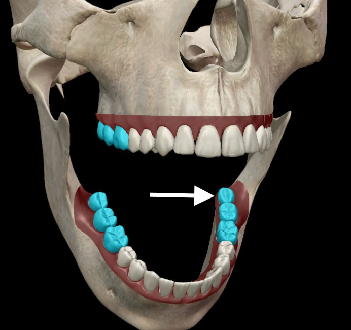 <p>What tooth is this in correct Tooth Notation form?</p>