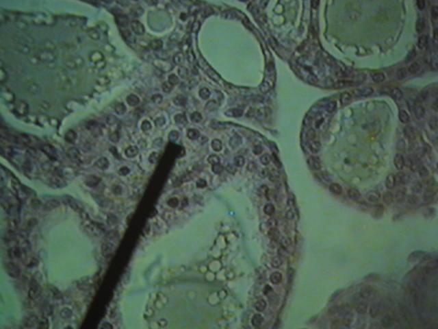 <p>Identify?</p><p>Lab Image 6-14</p>