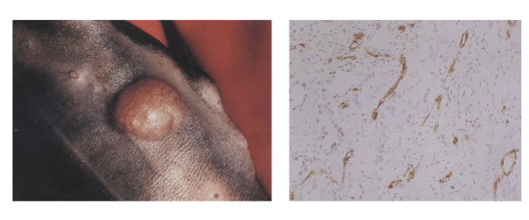 <ul><li><p>Tumours grown in mice <strong>subcutaneously or orthotopically</strong></p></li><li><p>Implant tumour cells in skin of mouse (skin at back is very loose)</p></li><li><p>Can see tumour grow under skin and follow its size</p></li><li><p>Effect of test substance on tumour size and animal survival established at regular intervals</p></li><li><p>Tumour can be taken then looked at under microscope</p></li><li><p>Histological analysis determines effects of drug on <strong>necrosis, thrombosis and microvessel density</strong></p></li></ul><p></p>