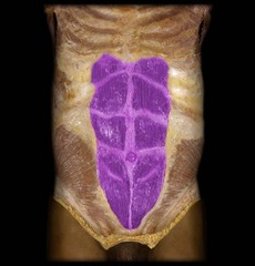 <p>Identify the structure</p>