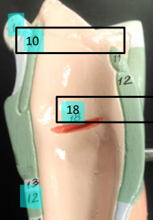 <p>Label this image.</p>