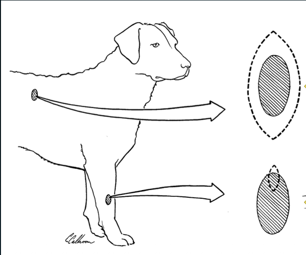 <p>The dotted lines indicate the surgical incision. Which diagram shows an excisional biopsy and which shows an incisional biopsy? </p>