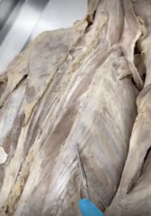 <p>Name the Muscle</p><p>- specific area of iliocostalis</p>