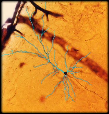 term image
