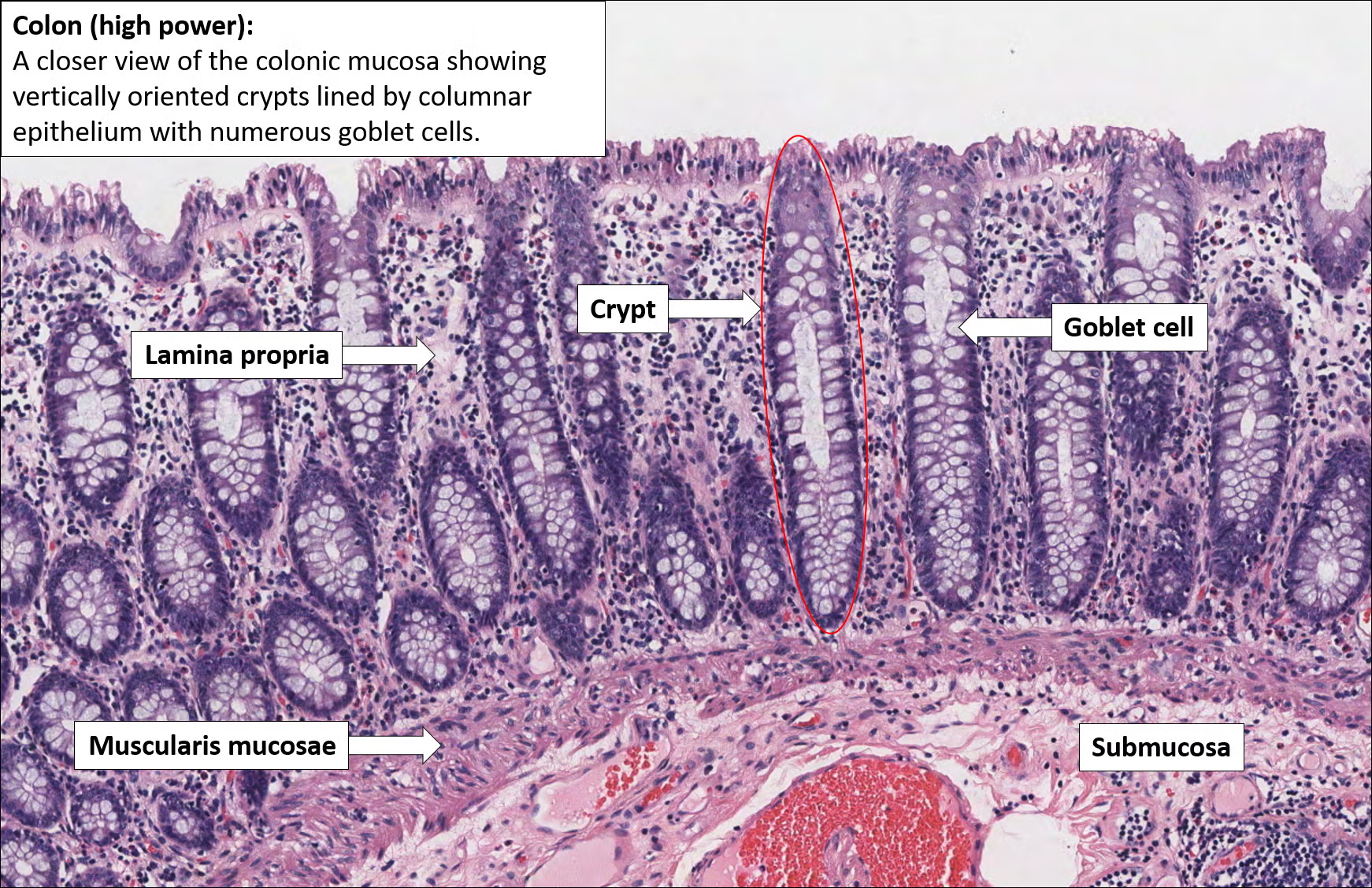 <p>colon</p>