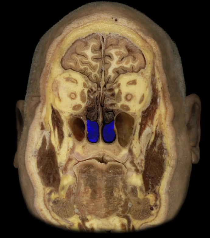 term image