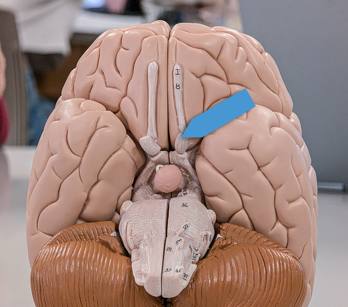 <p>Identify the structure at the pointer.</p>