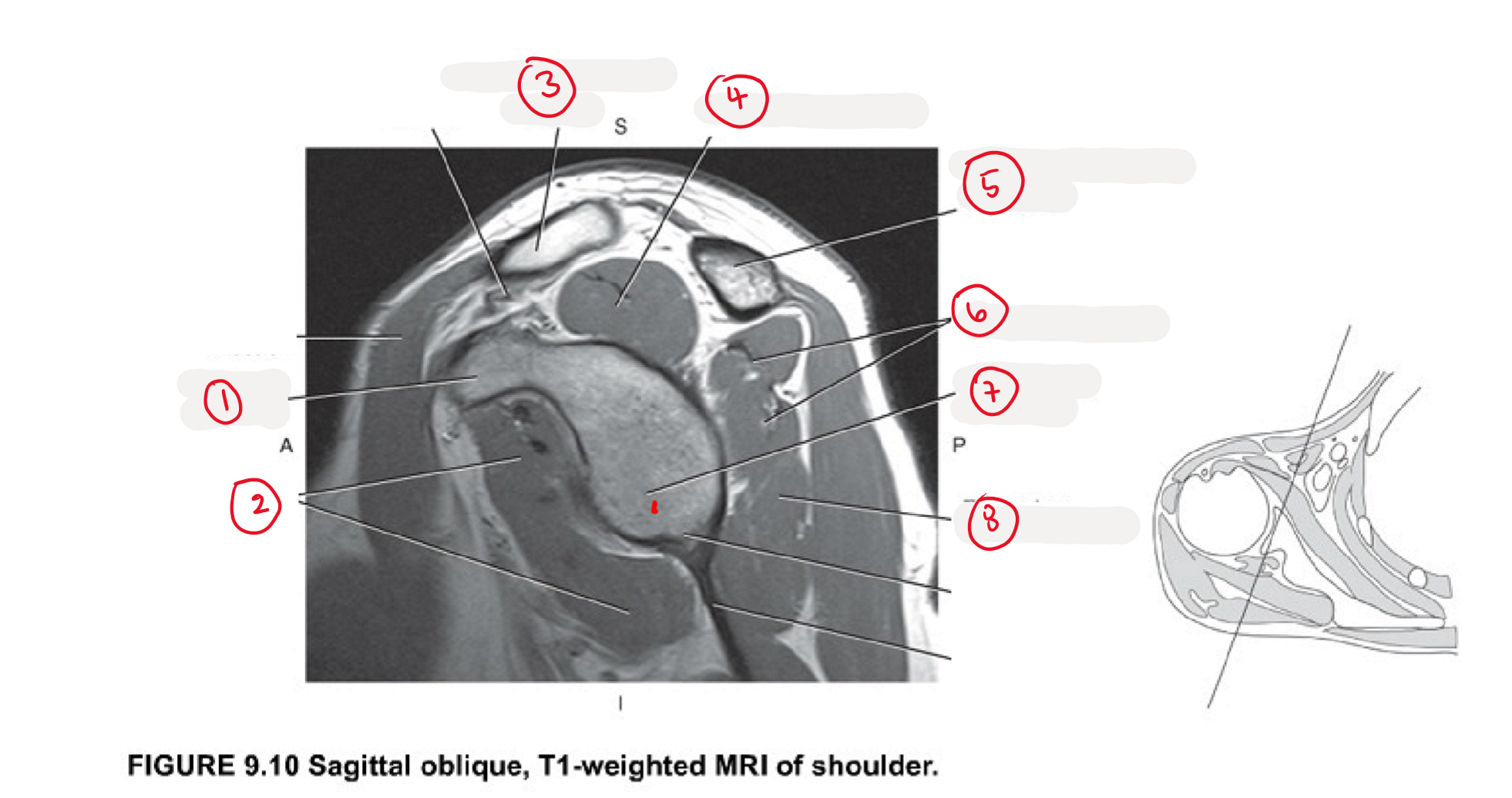 <p>(6)</p>