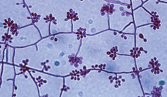 <p>The formation of arthroconidia is a characteristic important in the identification of all of the following, except:</p><p></p><p>Coccidioides</p><p>Geotrichum</p><p>Trichosporon</p><p>Sporothrix</p><p>Aureobasidium</p>