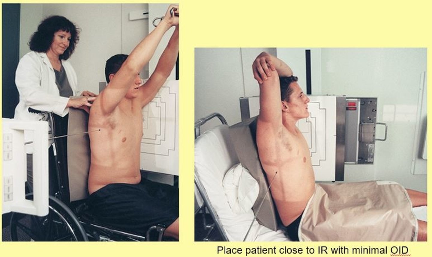 <p>- What exam is this?</p><p>- What is the SID?</p><p>- Is the patient shielded?</p><p>- How is the patient positioned in a wheelchair?</p><p>- How is the patient positioned in a stretcher?</p><p>- What is the CR?</p><p>- What are the breathing instructions?</p><p>- What anatomy is demonstrated?</p>