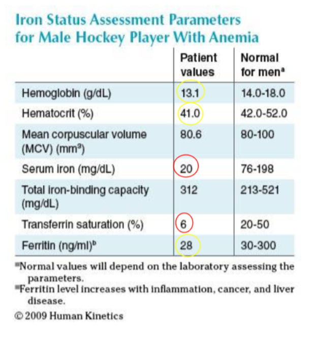 <p>CASE study 1: 25 yr old minor hockey player with blood work suggestive of Fe-deficiency anemia. On Fe-therapy. No obvious sources of blood loss. Dark stools. Hx of abdominal cramping attributed to the Fe-therapy. Rectal exam indicates stools +ve for occult blood. This athlete was subsequently diagnosed with Crohn’s disease based on his medical hx and blood work.</p><ul><li><p>based on his lab work + diagnosis what is the <strong><u>proposed intervention for Low iron?</u></strong><em> should you use supplements?</em></p></li></ul><p></p>
