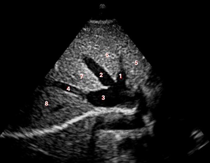 <p>Which of the following structures is labeled number #1?</p>