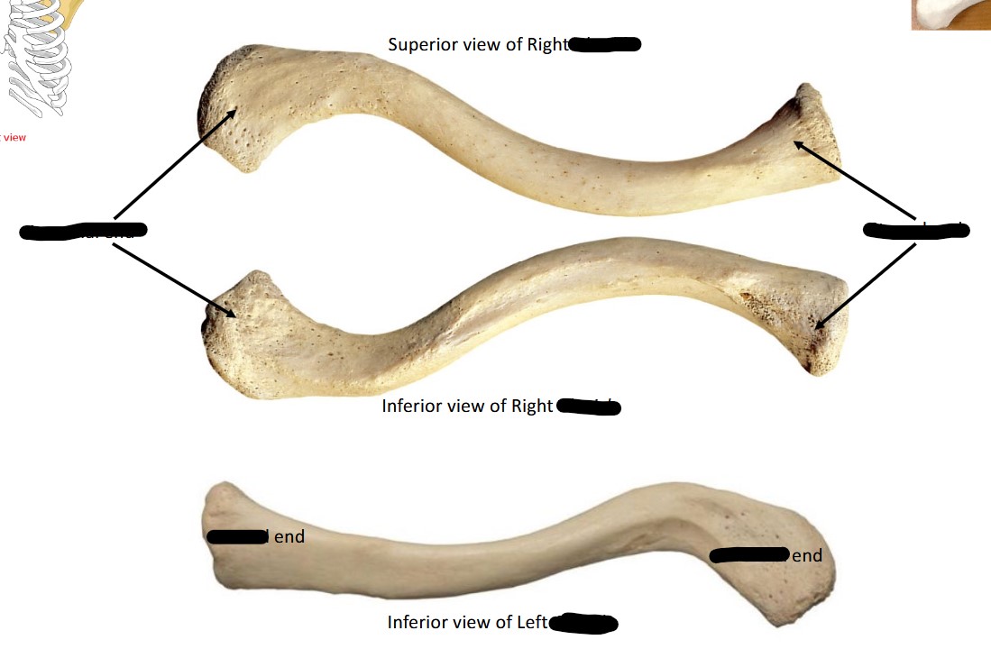 <p>Clavicle - Identify Bone and landmarks</p>