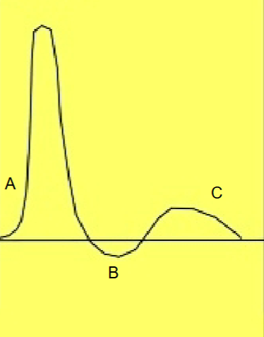 <p>Identify the phase &amp; direction of flow at point <span style="color: yellow;"><strong>C</strong></span></p>