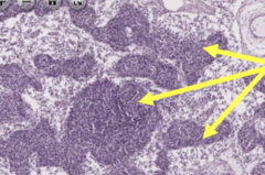 <p>dark staining area in medulla, consists of lymphocytes and other cells</p>