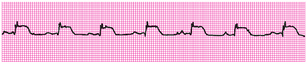 <p>Name this rhythm </p>