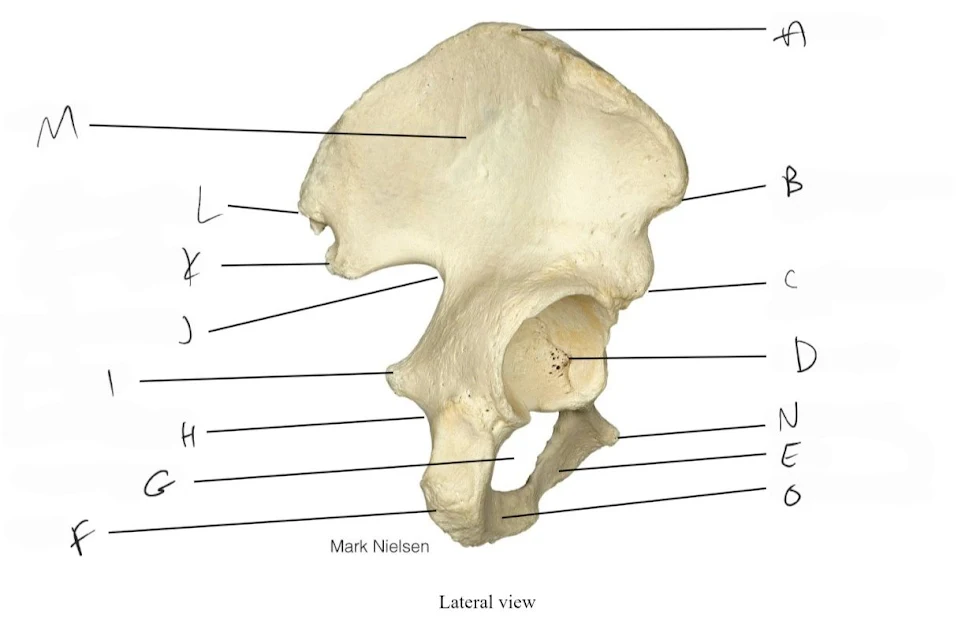 <p>posterior superior iliac spine</p>