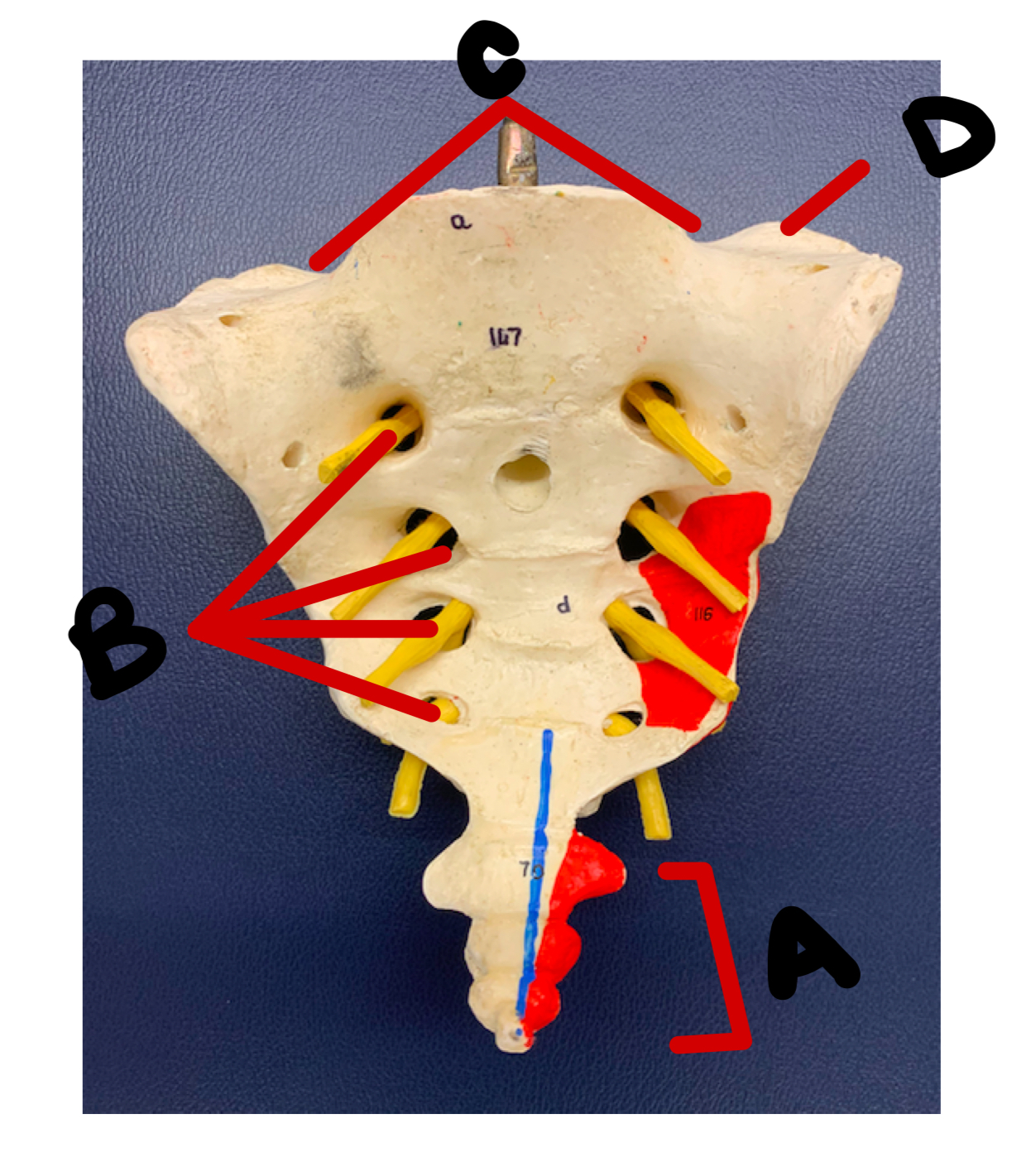 <p>B (what and inserts)</p>