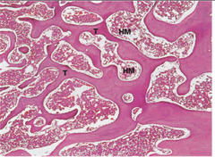 <p>Which type of bone is pictured?</p>