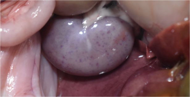 <p>What level of severity is shown?</p>