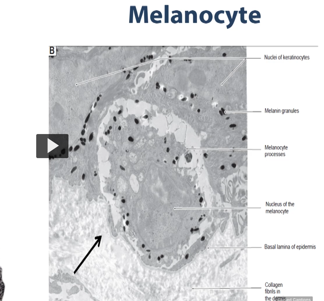 <p>So here we have another electron micrograph, this time illustrating the melanocytes. These are the cells that are in charge of making these electron dense granules which contain the pigment melanin. </p><p>These melanocytes will pack that melanin, and we will show in in a second how that melanin is distributed throughout the epidermis. </p>