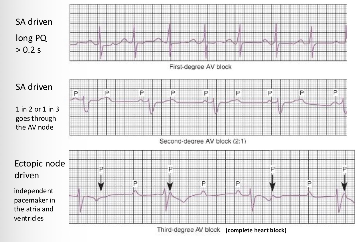 <p>Explain what happens in these pictures too:</p>