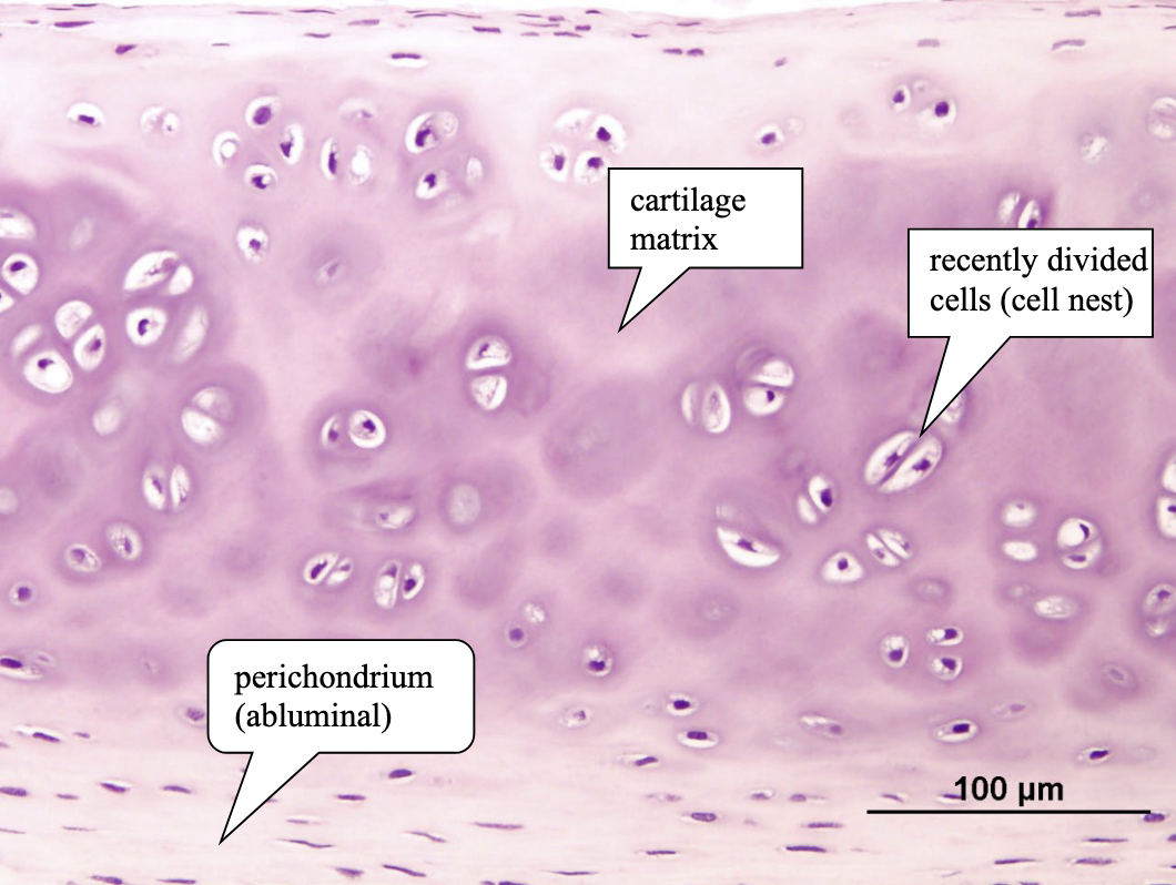 <p>what type of cartilage is shown here?</p>
