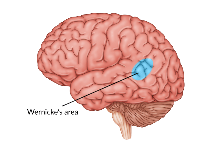 <p>Wernicke</p>