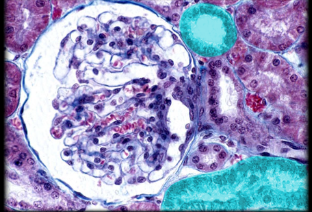 term image