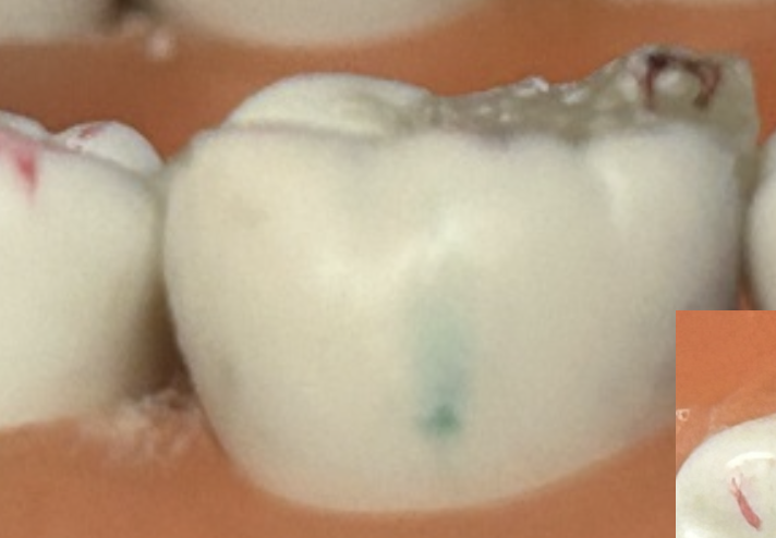 <p>This is an example of ______ interference</p>