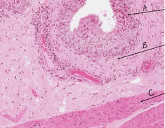 <p>What is indicated by the arrow labeled as 'C' in this urinary bladder slide?</p>