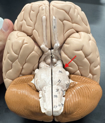 <p>(deep, not visualized here) trochlear</p>
