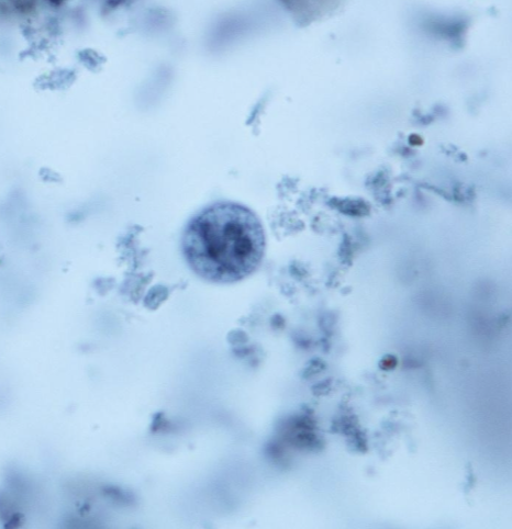 <p>What protist/cyst is this?</p>