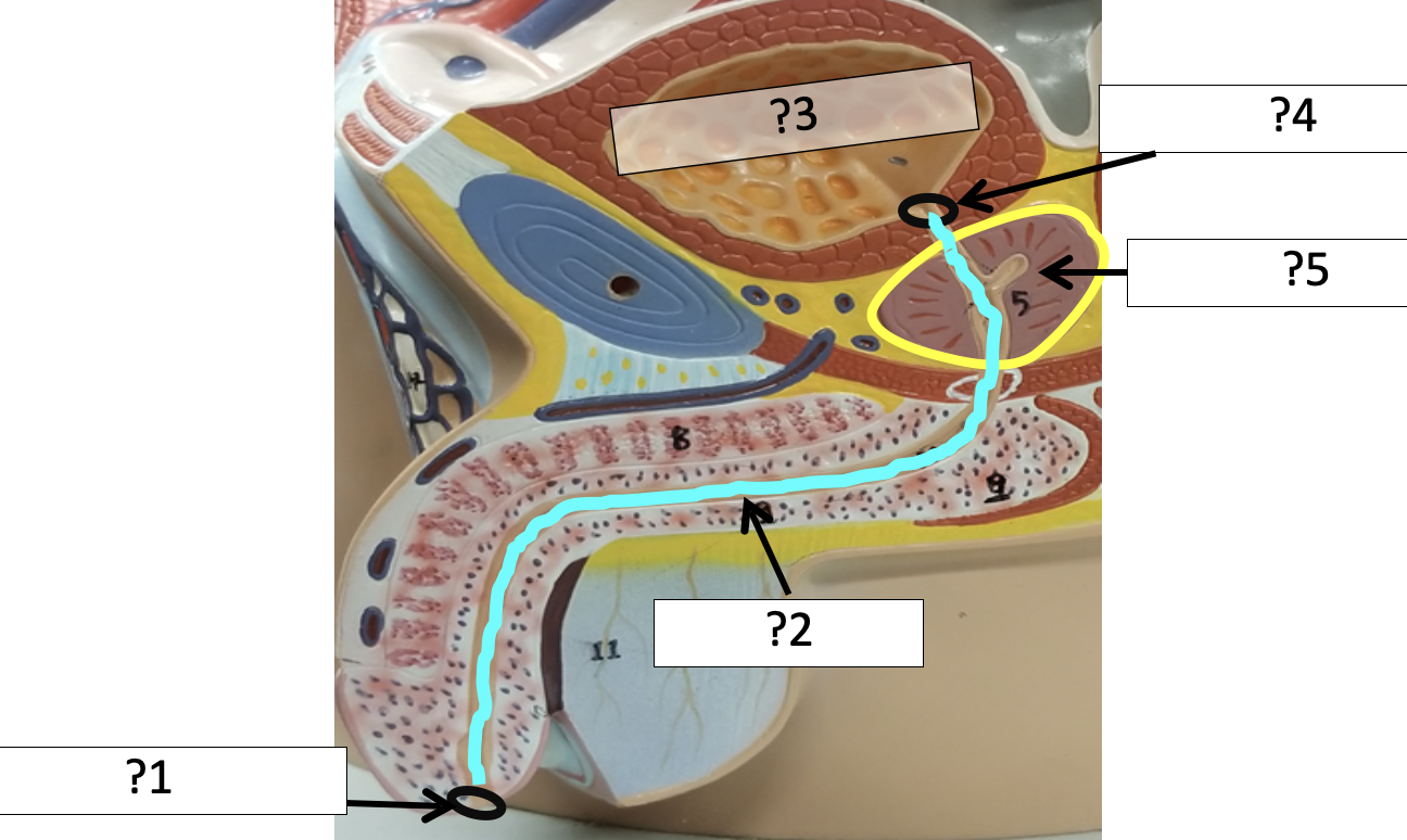 <p>4 Name the hole?</p>